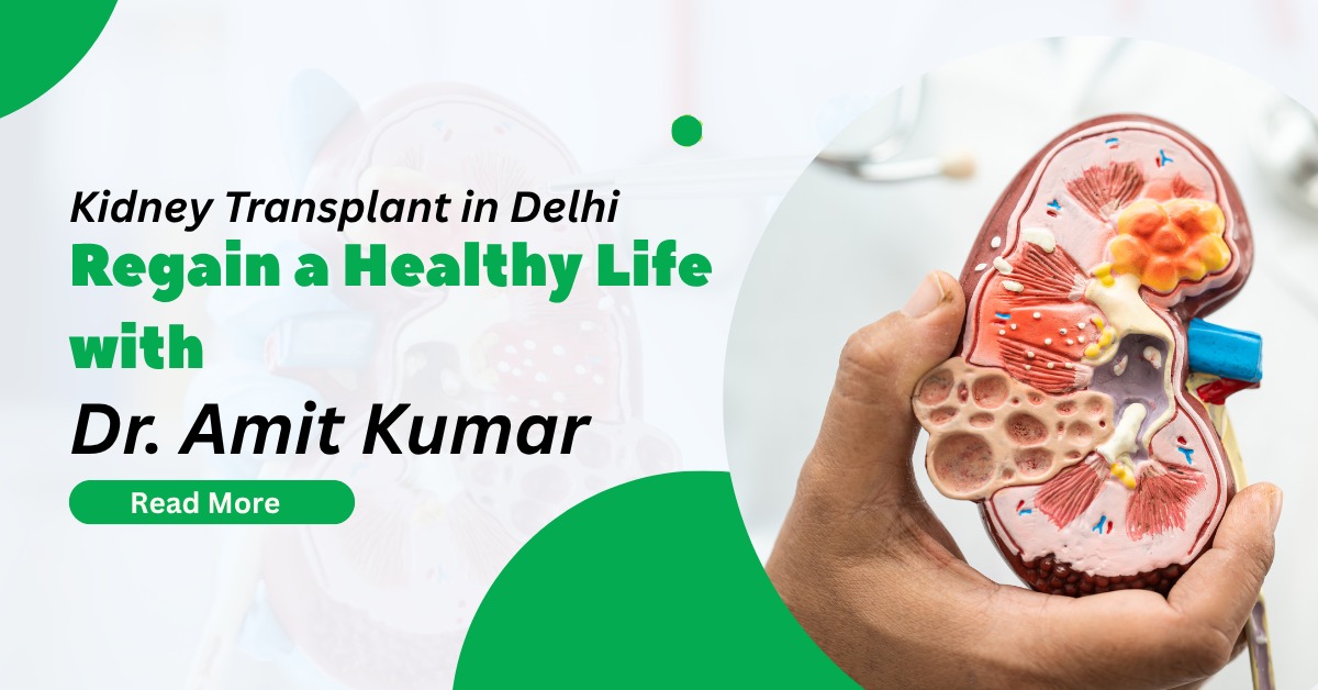 Kidney Transplant in delhi